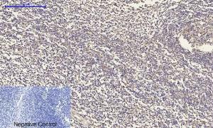 Immunohistochemical analysis of paraffin-embedded human Tonsil tissue using Anti-TR11B Antibody at 1:200 (4 °C overnight). Negative control was secondary Antibody only