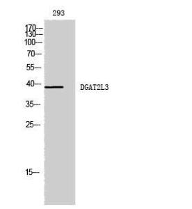 Anti-AWAT1 antibody