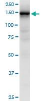 Anti-HMHA1 Mouse Monoclonal Antibody [clone: 4H7]