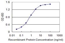 Anti-RNF25 Mouse Monoclonal Antibody [clone: 1D10]