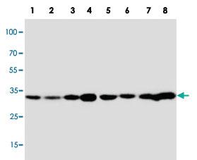 Anti-APOD Rabbit Polyclonal Antibody