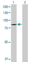 Anti-PLA2G6 Rabbit Polyclonal Antibody