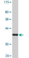 Anti-SSX3 Mouse Monoclonal Antibody [clone: 4A11]