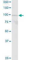 Anti-PLA2G6 Rabbit Polyclonal Antibody