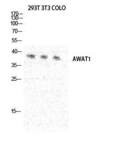 Anti-AWAT1 antibody