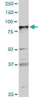 Anti-PLA2G6 Rabbit Polyclonal Antibody