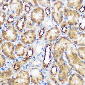 Immunohistochemistry analysis of paraffin-embedded rat kidney using Anti-WWC2 Antibody (A305615) at a dilution of 1:100 (40X lens). Perform microwave antigen retrieval with 10 mM PBS buffer pH 7.2 before commencing with IHC staining protocol