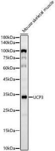 Western blot analysis of Mouse skeletal muscle, using Anti-UCP3 Antibody [ARC60308] (A309505) at 1:1,000 dilution. The secondary antibody was Goat Anti-Rabbit IgG H&L Antibody (HRP) at 1:10,000 dilution.