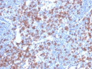 Immunohistochemical analysis of formalin-fixed, paraffin-embedded human lymph node using Anti-CD8A Antibody [rCD8/6590]