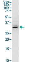 Anti-HADH Rabbit Polyclonal Antibody