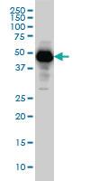 Anti-SERPINI1 Mouse Monoclonal Antibody [clone: 1D10]