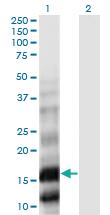 Anti-PLA2G10 Mouse Monoclonal Antibody [clone: 5G11]