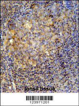 Anti-MME Rabbit Polyclonal Antibody