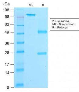 SDS-PAGE analysis of Anti-beta Catenin Antibody [rCTNNB1/2173] under non-reduced and reduced conditions; showing intact IgG and intact heavy and light chains, respectively. SDS-PAGE analysis confirms the integrity and purity of the antibody.