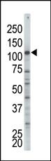 Anti-IKBKB Mouse Monoclonal Antibody