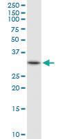 Anti-HADH Rabbit Polyclonal Antibody