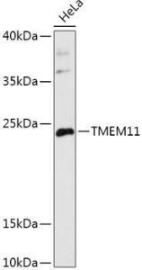 Western blot analysis of extracts of HeLa cells, using Anti-PM1 Antibody (A306830) at 1:1000 dilution. The secondary Antibody was Goat Anti-Rabbit IgG H&L Antibody (HRP) at 1:10000 dilution. Lysates/proteins were present at 25 µg per lane