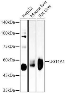 Western blot analysis of various lysates, using Anti-UGT1A1 Antibody [ARC57754] (A309507) at 1:4,000 dilution. The secondary Antibody was Goat Anti-Rabbit IgG H&L Antibody (HRP) at 1:10000 dilution. Lysates/proteins were present at 25 µg per lane