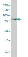 Anti-ACAP2 Mouse Monoclonal Antibody [clone: 4G3]