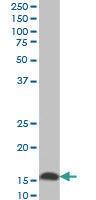 Anti-UBE2D2 Mouse Monoclonal Antibody [clone: 4A1]