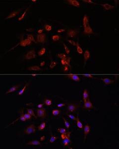 Immunofluorescence analysis of C6 cells using Anti-PM1 Antibody (A306830) at a dilution of 1:100. DAPI was used to stain the cell nuclei (blue)