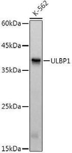 Western blot analysis of extracts of K-562 cells, using Anti-ULBP1 Antibody [ARC3064] (A309508) at 1:1,000 dilution The secondary antibody was Goat Anti-Rabbit IgG H&L Antibody (HRP) at 1:10,000 dilution Lysates/proteins were present at 25 µg per lane