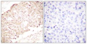 Antibody anti-SENP1 100 µg