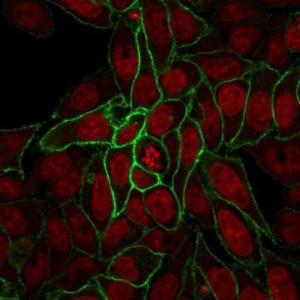 Immunofluorescent analysis of HeLa cells stained with Anti-beta Catenin Antibody [rCTNNB1/2173] (CF&#174; 488) (Green). Nuclear counterstain is RedDot.