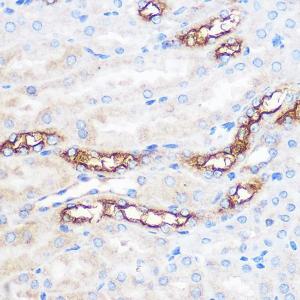 Immunohistochemistry analysis of paraffin-embedded mouse kidney using Anti-WWC2 Antibody (A305615) at a dilution of 1:100 (40X lens). Perform microwave antigen retrieval with 10 mM PBS buffer pH 7.2 before commencing with IHC staining protocol