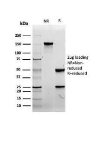 SDS-PAGE analysis of Anti-CD8A Antibody [rCD8/6590] under non-reduced and reduced conditions; showing intact IgG and intact heavy and light chains, respectively. SDS-PAGE analysis confirms the integrity and purity of the antibody.