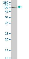 Anti-RFWD2 Mouse Monoclonal Antibody [clone: 1E4]