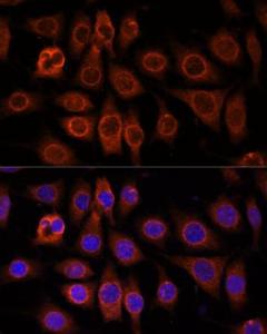 Immunofluorescence analysis of L929 cells using Anti-PM1 Antibody (A306830) at a dilution of 1:100. DAPI was used to stain the cell nuclei (blue)