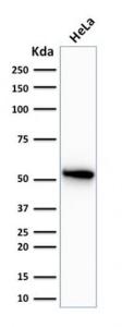 Western blot analysis of human HeLa cell lysate using Anti-Cytokeratin 7 Antibody [OV-TL12/30]