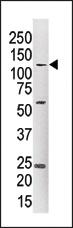 Anti-HK2 Rabbit Polyclonal Antibody