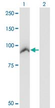 Anti-ACAP2 Mouse Monoclonal Antibody [clone: 4G3]