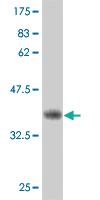 Anti-IRAK3 Mouse Monoclonal Antibody [clone: 1C8]