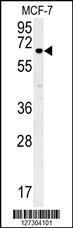 Anti-ESRP1 Rabbit Polyclonal Antibody (FITC (Fluorescein Isothiocyanate))