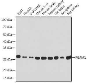 Western blot analysis of extracts of various cell lines, using Anti-PGAM1 Antibody [ARC0913] (A306831) at 1:1,000 dilution The secondary antibody was Goat Anti-Rabbit IgG H&L Antibody (HRP) at 1:10,000 dilution Lysates/proteins were present at 25 µg per lane