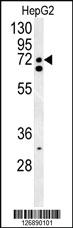 Anti-KCNK1 Rabbit Polyclonal Antibody