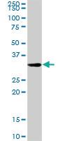 Anti-HADH Rabbit Polyclonal Antibody