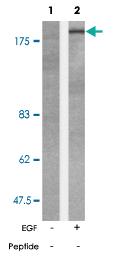 Anti-BCR Rabbit Polyclonal Antibody