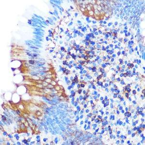 Immunohistochemistry analysis of paraffin-embedded human appendix tissue using Anti-PGAM1 Antibody [ARC0913] (A306831) at a dilution of 1:100 (40x lens) Perform microwave antigen retrieval with 10 mM PBS buffer pH 72 before commencing with IHC staining protocol