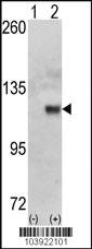 Anti-HK1 Rabbit Polyclonal Antibody