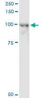 Anti-ACAP2 Mouse Monoclonal Antibody [clone: 4G3]