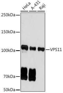 Western blot analysis of extracts of various cell lines, using Anti-VPS11 Antibody [ARC2325] (A306832) at 1:1,000 dilution