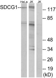 Anti-SDCG1 antibody