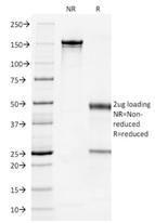 SDS-PAGE analysis of Anti-Cytokeratin 7 Antibody [OV-TL12/30] under non-reduced and reduced conditions; showing intact IgG and intact heavy and light chains, respectively. SDS-PAGE analysis confirms the integrity and purity of the Antibody