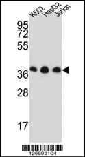 Anti-HNRNPDL Rabbit Polyclonal Antibody