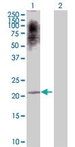 Anti-ATF3 Rabbit Polyclonal Antibody