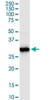 Anti-HADH Rabbit Polyclonal Antibody